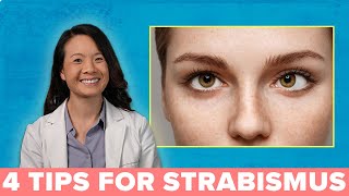 4 Great Ways to Treat Your Strabismus [upl. by Acirre]