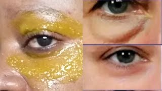 I USE TURMERIC EYE TREATMENT TO REMOVE PUFFY EYE CIRCLES IN 5 DAYS [upl. by Leanne]