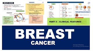 BREAST CANCER  Signs amp Symptoms  Part 3 [upl. by Elaweda]