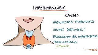 Hypothyroidism and Hashimotos Thyroiditis Visual Explanation for Students [upl. by Estele]