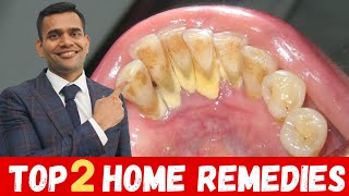 Top 2 Remedies To Remove Dental Plaque  Remove Dental Plaque and keep Oral Hygiene Healthy At Home [upl. by Shelman890]