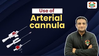 Use of Arterial cannula  DAMS Nursing [upl. by Pastelki]