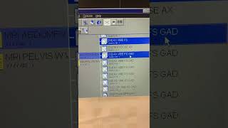 For MRI Techs How to perform manual subtractions on MRI scanner [upl. by Liahcim564]