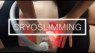 Cryoskin Révolution Tutorial cryoslimming hips session [upl. by Elyrad201]