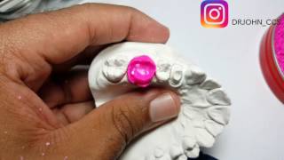 WaxUp Tutorial Primer Molar Superior Permanente Por John Monges Bonacia DEMO [upl. by Novej257]