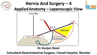 Mastering Hernia Surgery  4 Applied anatomy for Laparoscopic Inguinal hernia  Edusurg Clinics [upl. by Krongold]