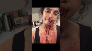 Priyanka Chopra Injuries from an Action Movie  Priyanka Chopra Movie  priyankachopra [upl. by Enrobso]