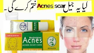 Mentholatum scar Care cream review with price [upl. by Akienaj983]