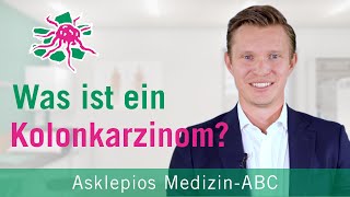 Was ist ein Kolonkarzinom  Medizin ABC  Asklepios [upl. by Pepin]