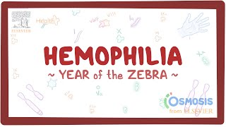 Hemophilia Year of the Zebra [upl. by Idnyl15]