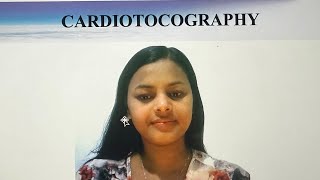 CARDIOTOCOGRAPHY FOR NURSES AND NCLEX EXAM [upl. by Siclari]