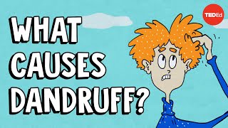 What causes dandruff and how do you get rid of it  Thomas L Dawson [upl. by Idas]