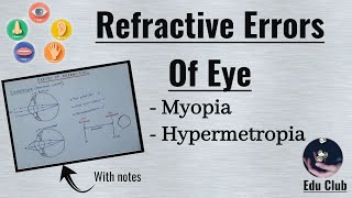 Refractory Errors Of Eye  Myopia  Hypermetropia  Special Senses Physiology [upl. by Schargel]