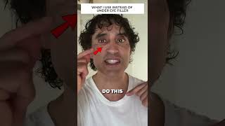 DISSOLVING MY UNDER EYE FILLER REACTION [upl. by Averi]