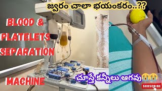 జ్వరం వచ్చి రక్తకణాలు తగ్గిపోయేవి critical situation  Low Blood Platelets in thphoid fever [upl. by Cud]