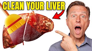 Top BEST Foods to Clean Out Your Liver [upl. by Artemed]