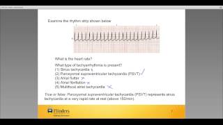 Cardiac rhythm review [upl. by Bodkin768]