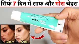 Moon Glow Cream Review  moon glow cream ke fayde  moon glow cream kaise use kare [upl. by Marba]