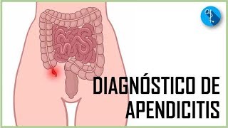 DIAGNÓSTICO DE APENDICITIS AGUDA  Aprendiendo Medicina MEDX [upl. by Fisch325]