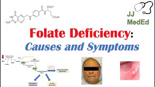 Folate Deficiency Causes ex medications Pathogenesis Symptoms Diagnosis and Treatment [upl. by Rhynd607]