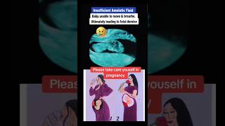 Baby unable to move due to insufficient amniotic fluid😥😥viralvideo trending viralshorts [upl. by Hareema]