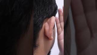 Correcting Folded Ears  Otoplasty  Dr Sunil Richardson [upl. by Zahc]