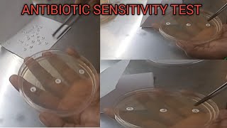 Antibiotic Sensitivity Test  AST  MHA MEDIA  Antibiotics test करना सीखें [upl. by Jenna]