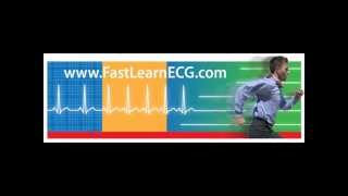 12lead ECGEKG Differentiating between atrial and ventricular arrhythmias [upl. by Candida135]