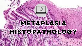 METAPLASIA  HISTOPATHOLOGY AND MORPHOLOGY [upl. by Lashond]