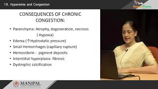 Hyperemia amp Congestion [upl. by Nima]