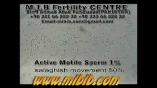 active motile sperm 1 sluggish motile 50 videolow sperm count video [upl. by Salmon]