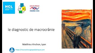 le diagnostic de macrocrânie [upl. by Fredella]