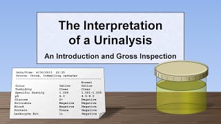 Interpretation of the Urinalysis Part 1  Introduction and Inspection [upl. by Yekciv]