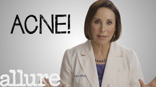 What is Acne and How Do I Get Rid of it Forever  Allure [upl. by Jaban]