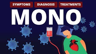 What is MONO Symptoms Diagnosis amp Treatments [upl. by Arodasi]