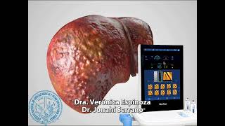 Guía Práctica ¿Cómo Realizar un FibroScan [upl. by Odrawde727]