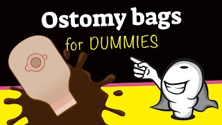 Ostomy bags for dummies [upl. by Diandre932]