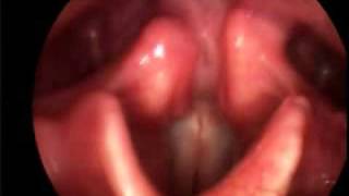 Singing Vocal Folds [upl. by Ax]