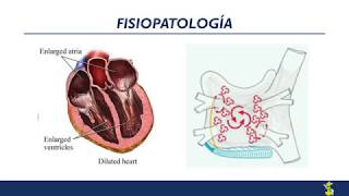 Fibrilación auricular Diagnóstico y tratamiento [upl. by Emsoc]