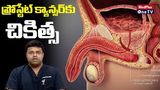 Prostate Cancer Treatment  DrSarath Chandra Reddy MedPlusONETV [upl. by Leerzej698]