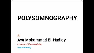 Polysomnography sleep Study [upl. by Mosnar]