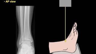 Anatomy of Ankle Xrays [upl. by Grube]