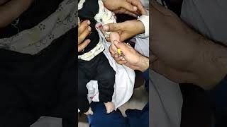 Cannula procedure easy pass youtubeyoutuberloveyoutubeshortsytshortsyoutubevideoyoutubevideos [upl. by Hsekar]