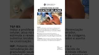 Ativos para tratar cicatriz de acne [upl. by Nairolf]