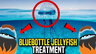 Bluebottle Jellyfish Stings What You Need to Know amp How to Treat Them [upl. by Nich]