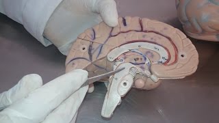 Diencephalon small model  Practical anatomy 2nd year [upl. by Lalla]