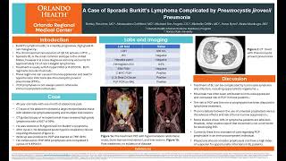 A Case of Sporadic Burkitt’s Lymphoma Complicated by Pneumocystis jirovecii Pneumonia [upl. by Assened]