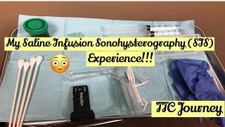 My Saline infusion sonohysterography Experience  SIS Test  TTC  Fertility Infertility Journey [upl. by Aymahs]