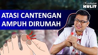 TIPS AMPUH MENGOBATI CANTENGAN  DOKTER SADDAM ISMAIL [upl. by Alisun]