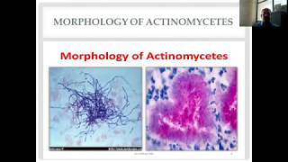 Actinomycetes and Nocardia Diverse Group of Gram Positive Bacilli [upl. by Lennard693]